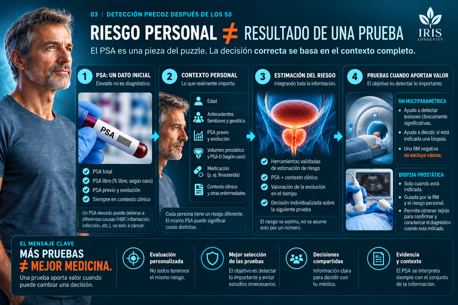 Infografía IRIS sobre detección precoz del cáncer de próstata: PSA, contexto personal, estimación de riesgo, resonancia magnética y biopsia