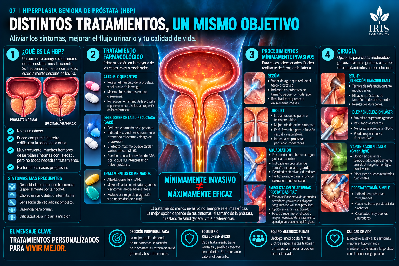 Infografía IRIS sobre HBP, medicamentos, procedimientos y cirugía