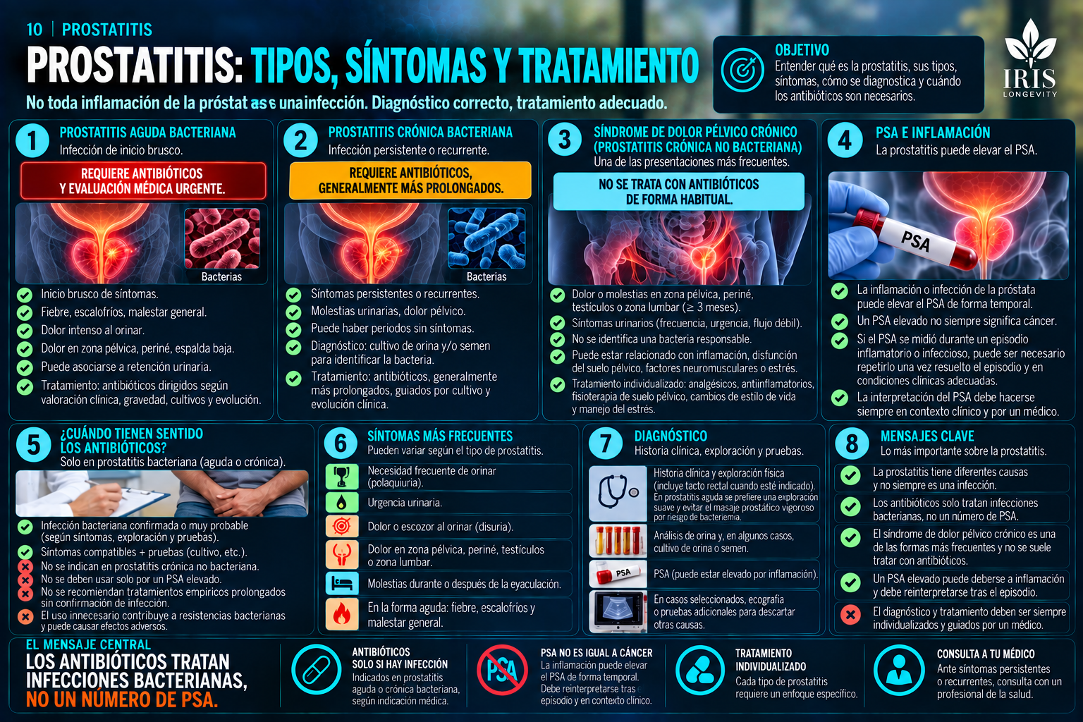 Infografía IRIS sobre prostatitis bacteriana, dolor pélvico crónico, PSA y antibióticos